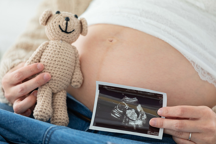 マタニティフォト|準備しておきたいおすすめ小物