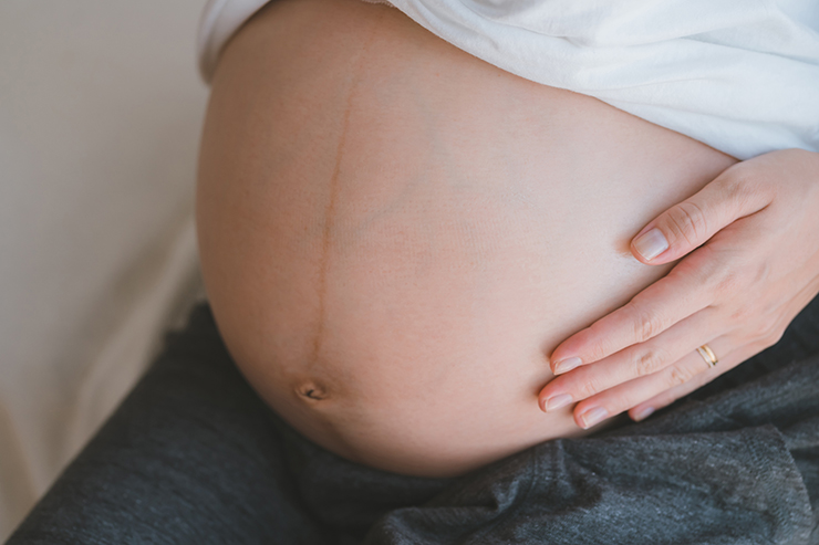 マタニティフォトで気になる妊娠線!なぜできるの?